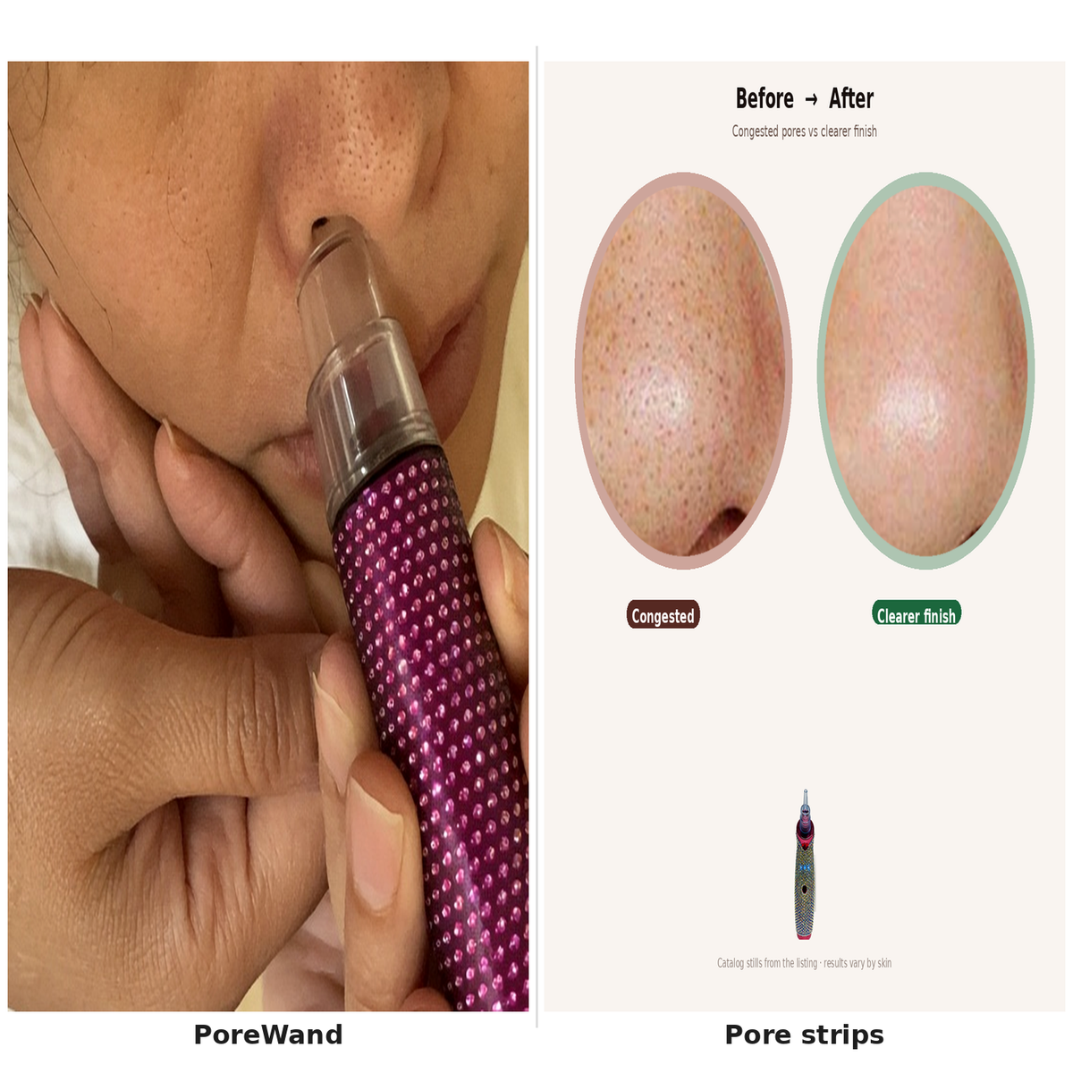 PoreWand vs pore strips