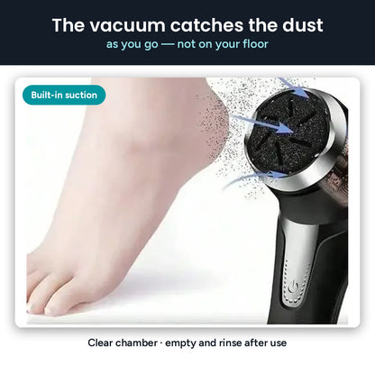 Built-in vacuum pulls skin dust into the chamber